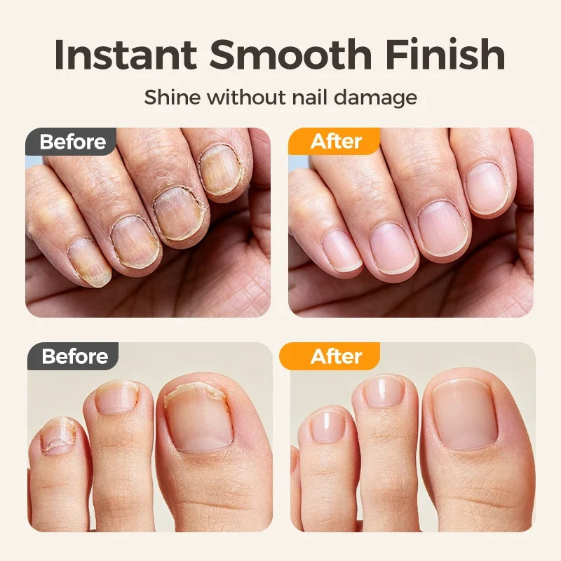 🔥Last Day 50% OFF -✂️ 2-in-1 Smart Electric Nail Clipper & Polisher – Anti-Pinch Safety & LED Light 💅