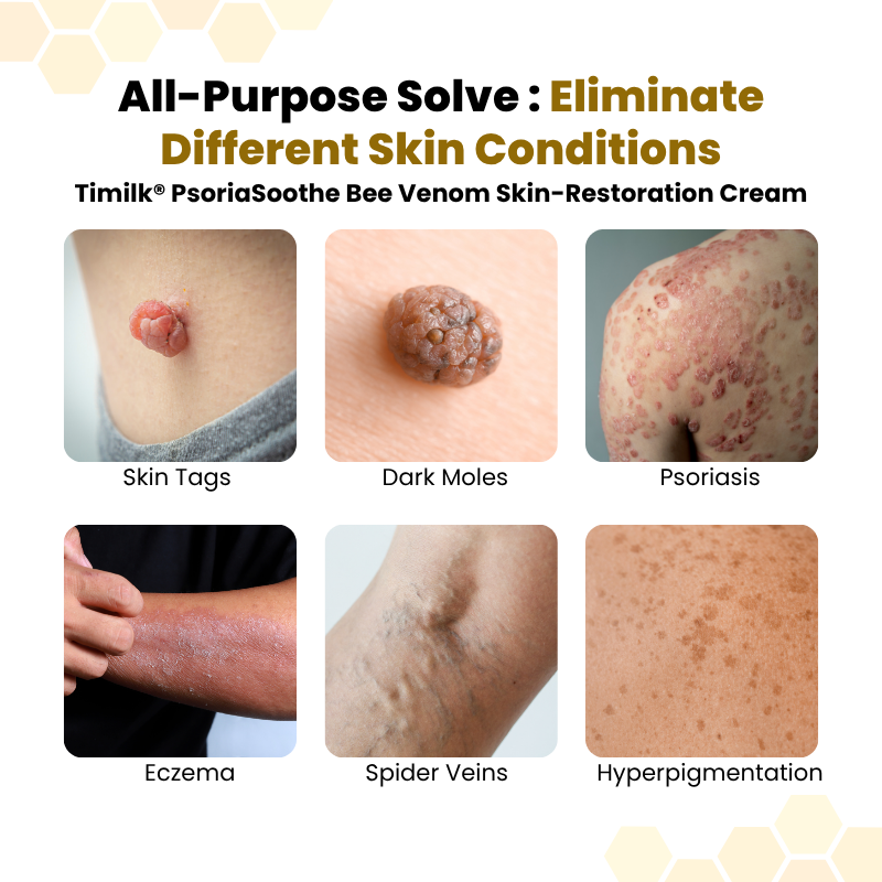 Timlk® Bee Venom Skin-Restoration Cream
