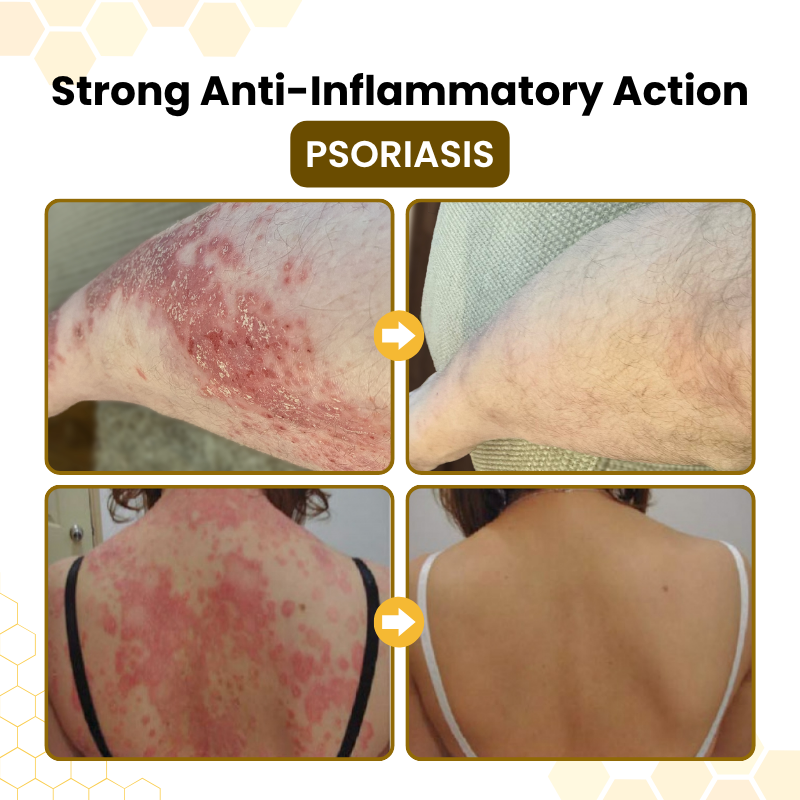 Timlk® Bee Venom Skin-Restoration Cream